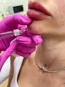Injection cosmetology