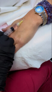 Injection cosmetology