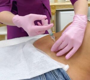 Injection cosmetology
