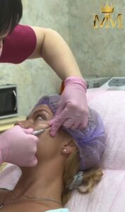 Injection cosmetology